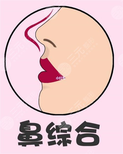 如何能讓自己的鼻子變高變挺 鼻子整形手術(shù)會(huì)有什么后遺癥 鼻子整形手術(shù)的后遺癥有哪些是什么