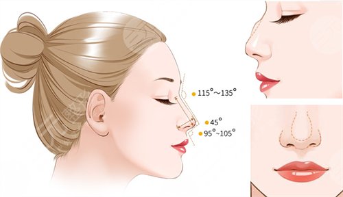 如何能讓自己的鼻子變高變挺 鼻子整形手術(shù)會(huì)有什么后遺癥 鼻子整形手術(shù)的后遺癥有哪些是什么