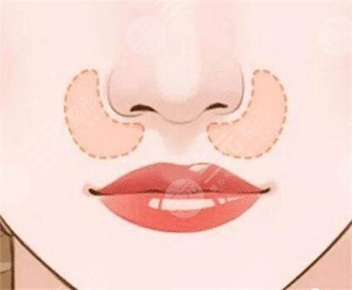 如何能讓自己的鼻子變高變挺 鼻子整形手術(shù)會(huì)有什么后遺癥 鼻子整形手術(shù)的后遺癥有哪些是什么