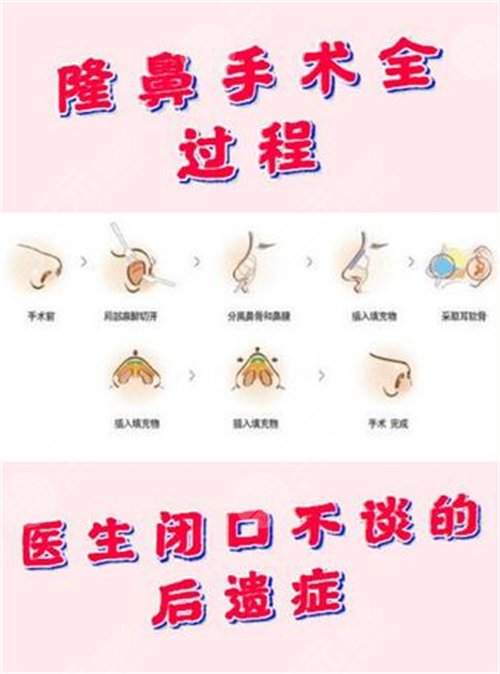 如何能讓自己的鼻子變高變挺 鼻子整形手術(shù)會(huì)有什么后遺癥 鼻子整形手術(shù)的后遺癥有哪些是什么