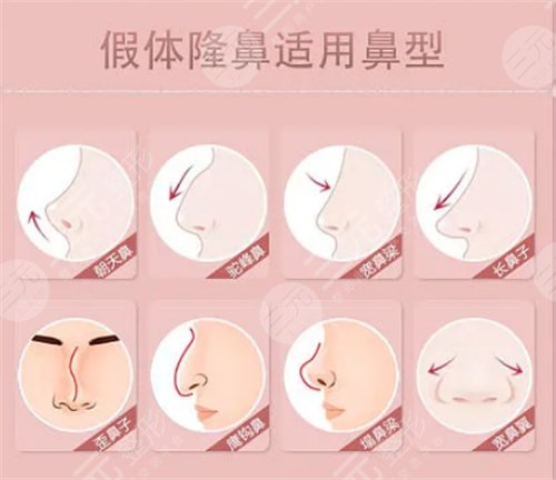 如何能讓自己的鼻子變高變挺 鼻子整形手術(shù)會(huì)有什么后遺癥 鼻子整形手術(shù)的后遺癥有哪些是什么