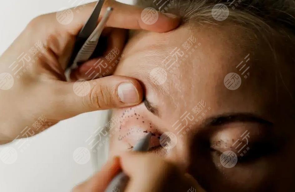 女子整容整出九級(jí)傷殘是真的嗎?