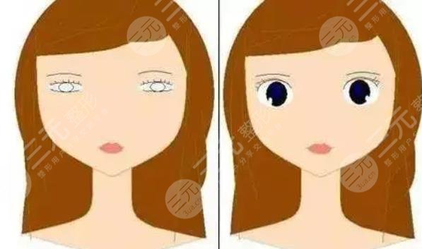 女子割雙眼皮!當(dāng)場(chǎng)喪命