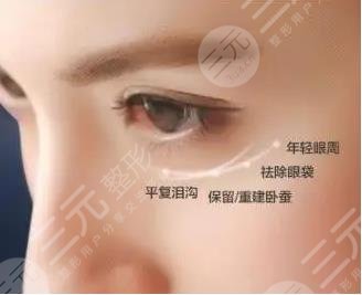 超聲波去眼袋優(yōu)勢