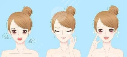 超聲波去眼袋果