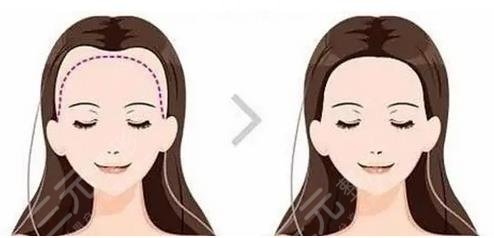 頭發(fā)種植果