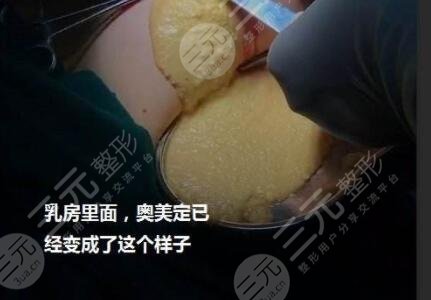 取奧美定可以醫(yī)保報(bào)銷嗎？