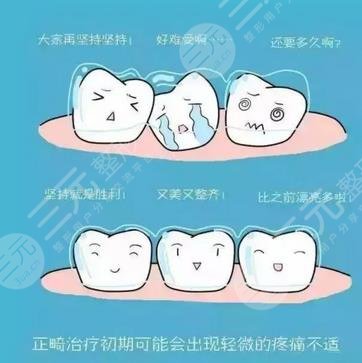 牙齒矯正優(yōu)勢