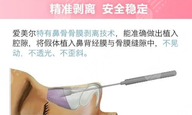 美迪菲假體和韓式生科哪個好?哪個貴?美迪菲假體