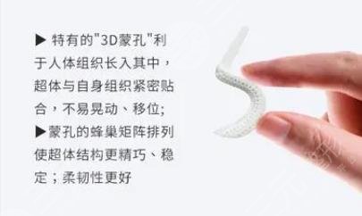 超體隆鼻和膨體哪個好?優(yōu)點分析