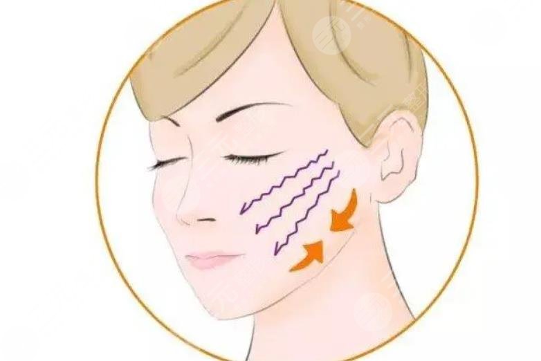 哪些因素影響臉部提拉手術(shù)費用