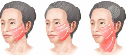 北京明會(huì)紅醫(yī)療美容診所擅長(zhǎng)項(xiàng)目介紹