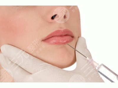 嘴唇厚怎么變??？幾點日常小妙招分享！附上唇部整形手術(shù)介紹～