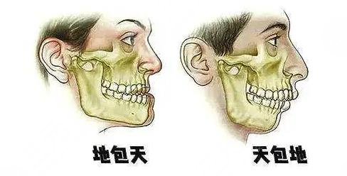 天包地矯正后臉型變化圖