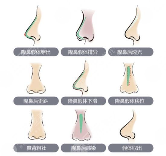 北京伊美爾何禎平醫(yī)生擅長(zhǎng)項(xiàng)目科普