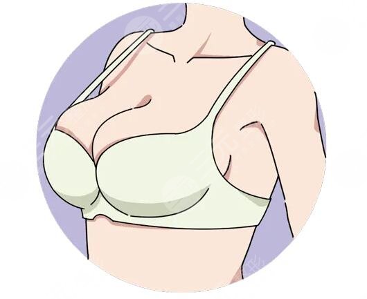 胸部整形