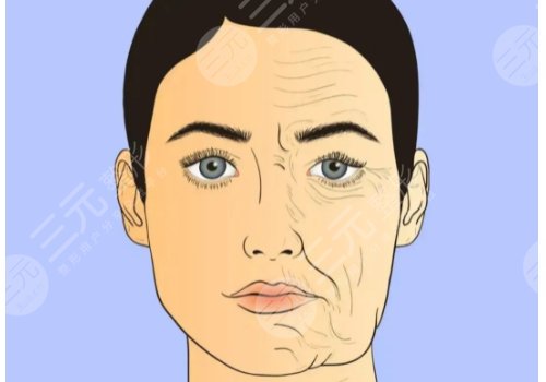 面部下垂整形多少錢？手術(shù)費(fèi)用搶先看！附熱瑪吉與介紹~