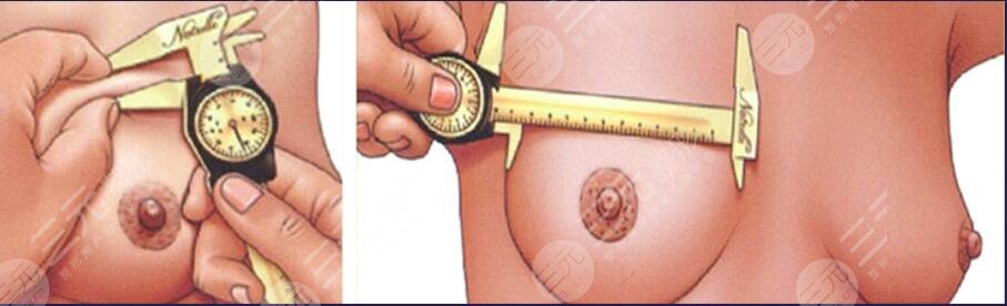 深圳田浩醫(yī)生隆胸怎么樣?