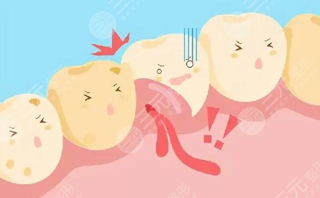 健康牙齦的顏色是什么顏色的？白色更健康是真的嗎？事實會突破你的認知~