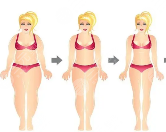 宜昌中心醫(yī)院抽脂案例分享：