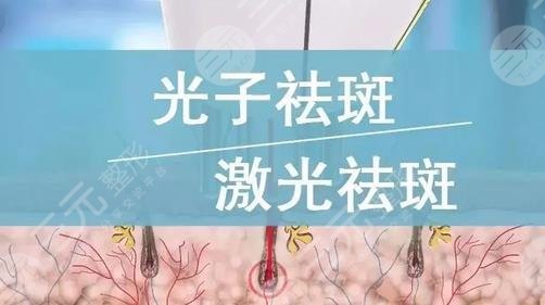 南方醫(yī)科大學(xué)深圳醫(yī)院祛斑好嗎