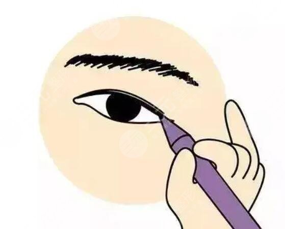 美瞳線后1至7天的變化圖