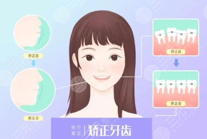 牙齒矯正年齡限制在多少歲？幾歲是正畸的黃金年齡？來看看你處在哪個(gè)年齡段！