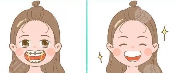 牙齒矯正年齡限制在多少歲？