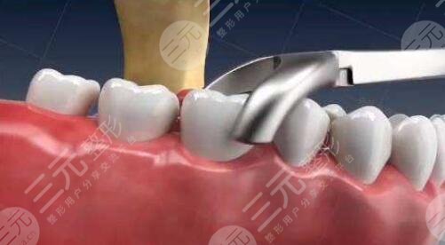 廣州柏德口腔醫(yī)院科普介紹