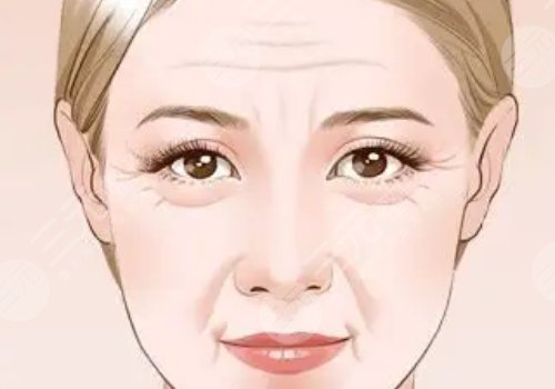 去法令紋的小竅門