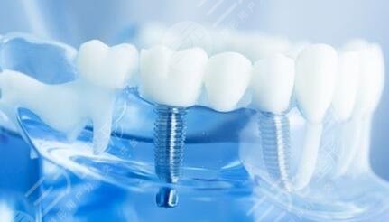 廣州柏德口腔科普介紹