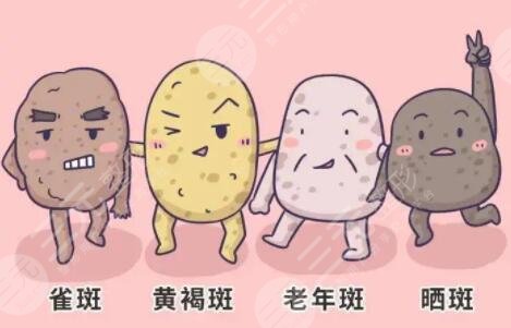 彩光祛斑會(huì)反彈嗎?