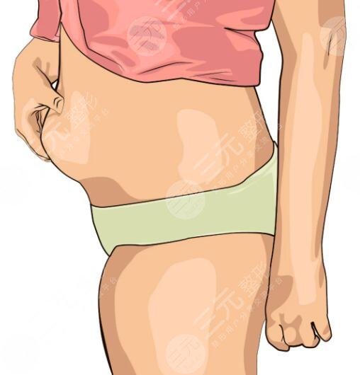 腹部吸脂減肥手術(shù)后要注意的問題