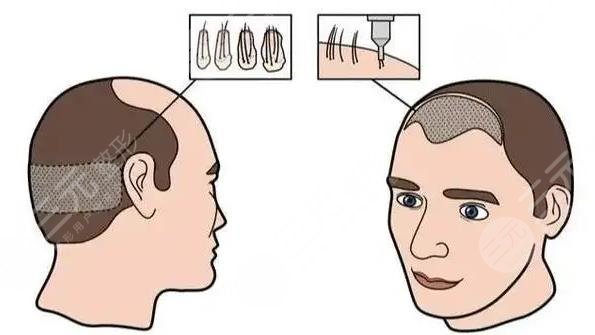 緩解脫發(fā)小妙招(民間偏方)