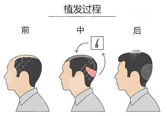 緩解脫發(fā)小妙招(民間偏方)