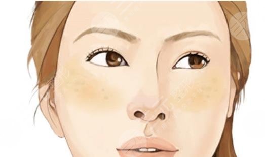 艾灸去黃褐斑多久見