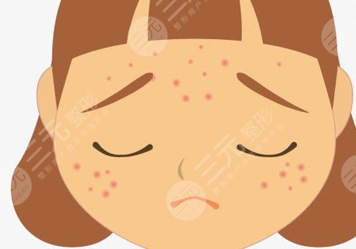 復(fù)合激光祛斑果如何?