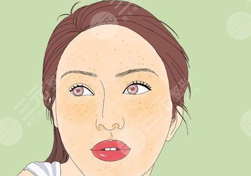 復(fù)合激光祛斑果如何?