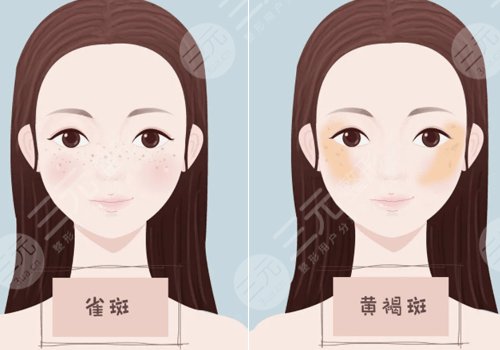 復(fù)合激光祛斑果如何?