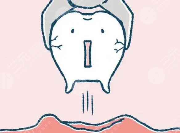 智齒痛怎么快速止痛?簡單的辦法盤點