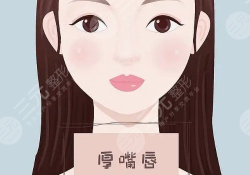 厚唇變薄手術(shù)多少錢？