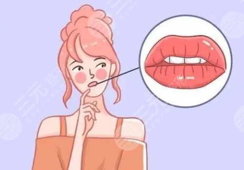 厚唇變薄手術(shù)多少錢？