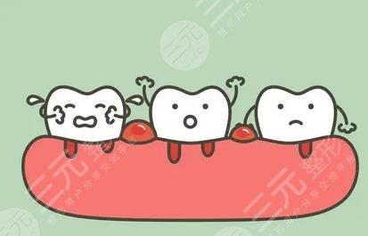 牙齦腫痛有膿包怎么辦?