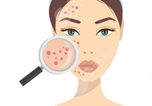臉上長痘印如何消除?