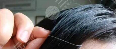 長(zhǎng)白頭發(fā)了是什么原因?qū)е碌?