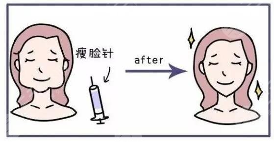 咬肌大怎么辦怎么改良快速又有？怎么判斷自己咬肌是否過大？