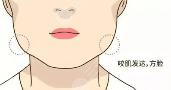 咬肌怎么變小快速的方法不動(dòng)刀！照搬文中的方法可以讓你更快的變小臉~