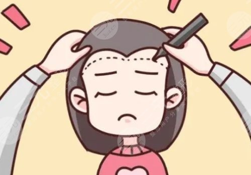 發(fā)際線高怎么挽救?