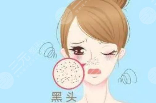 去黑頭收縮毛孔