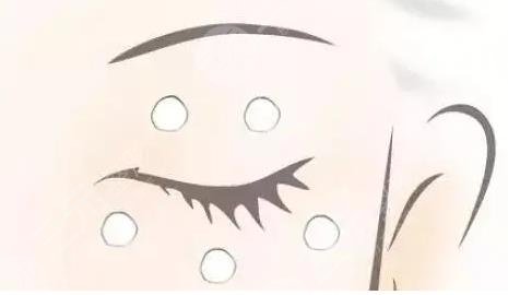 眼睛周圍長脂肪粒怎么辦?